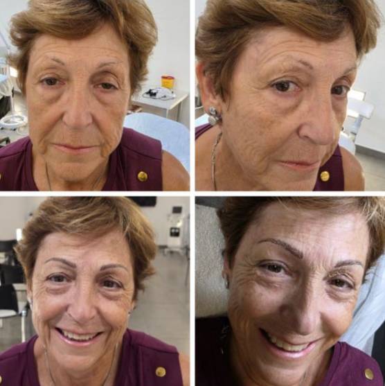 micropigmentación cejas baena